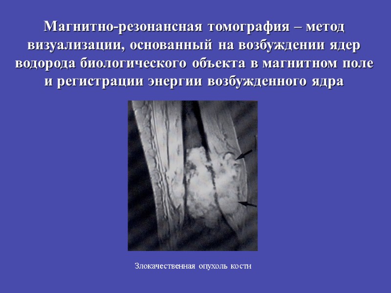 Магнитно-резонансная томография – метод визуализации, основанный на возбуждении ядер водорода биологического объекта в магнитном